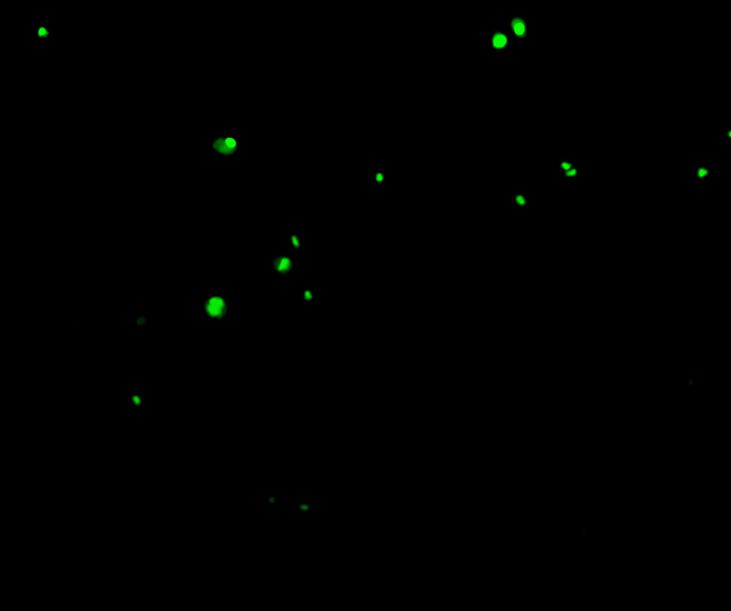 膀胱脱落细胞荧光染色数据集（包含1000多张荧光细胞照片）