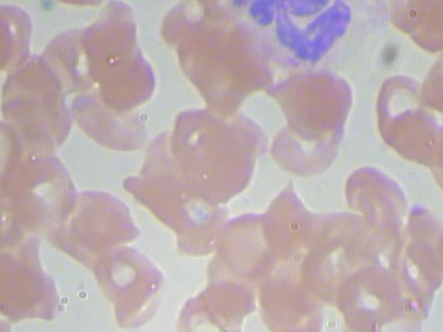 红细胞完整标注（367个显微镜图像）