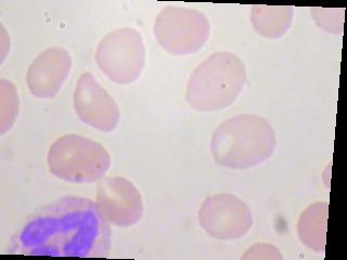 该数据集包含12,500张带有细胞类型标签(CSV)的增强血细胞图像(JPEG)。4种不同细胞类型中的每一种都有大约3,000张图像,这些图像被分组到4个不同的文件夹中(根据细胞类型)。细胞类型是嗜酸性粒细胞、淋巴细胞、单核细胞和中性粒细胞。