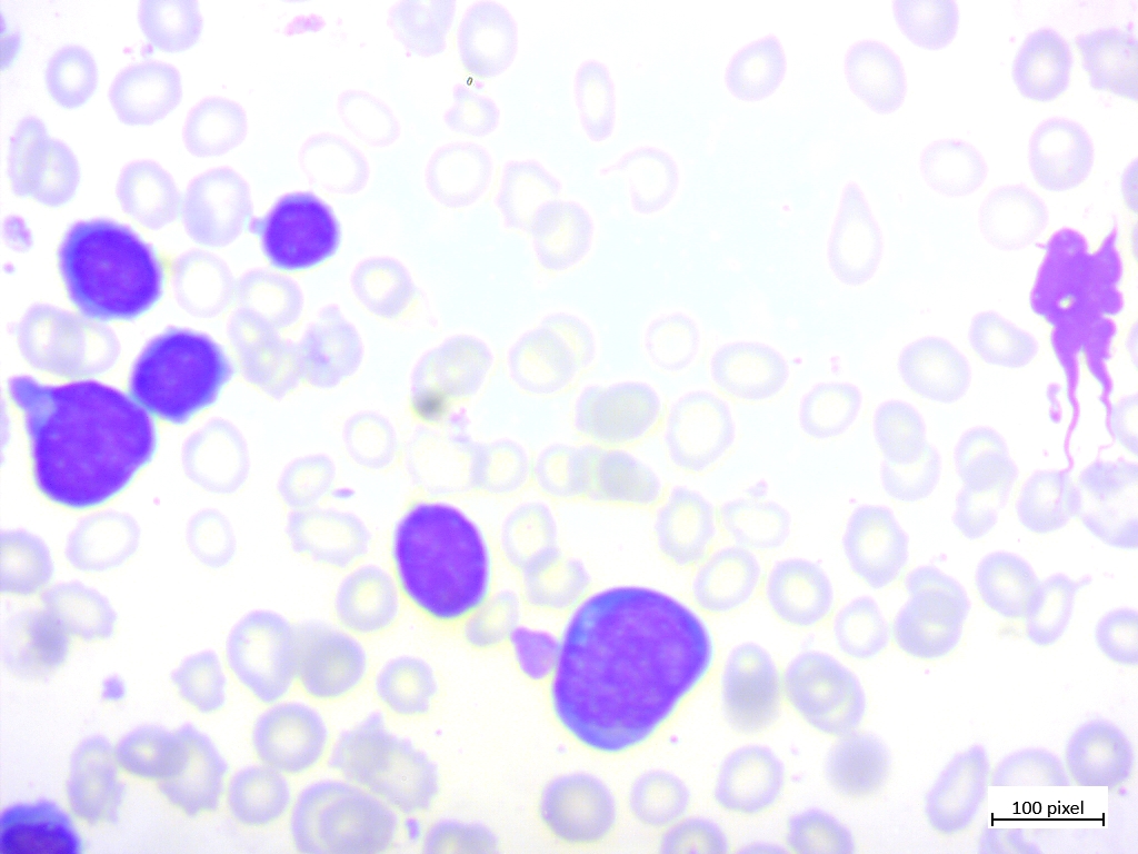癌症数据集-血液组织显微镜图片,分为4类肿瘤图片,共3242张图片