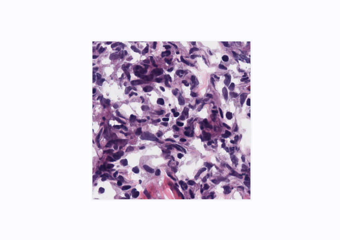 H＆E染色实验的样本，冷冻切片的H＆E染色组织学图像的核分割数据，几百张图片，并做好标注