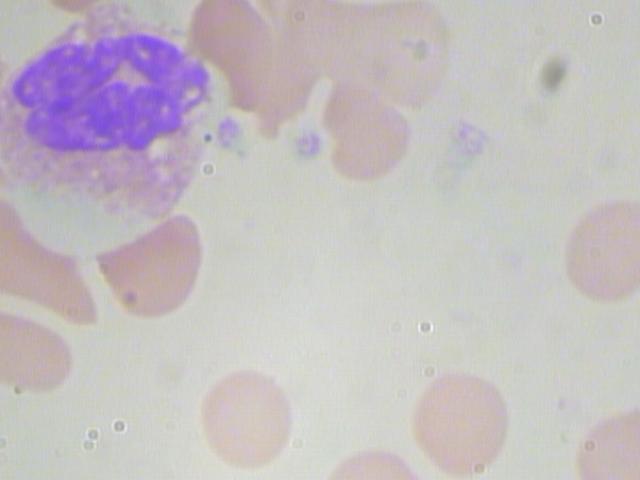 该数据集包含12500张血细胞增强图像(JPEG),并带有伴随的细胞类型标签(CSV)。