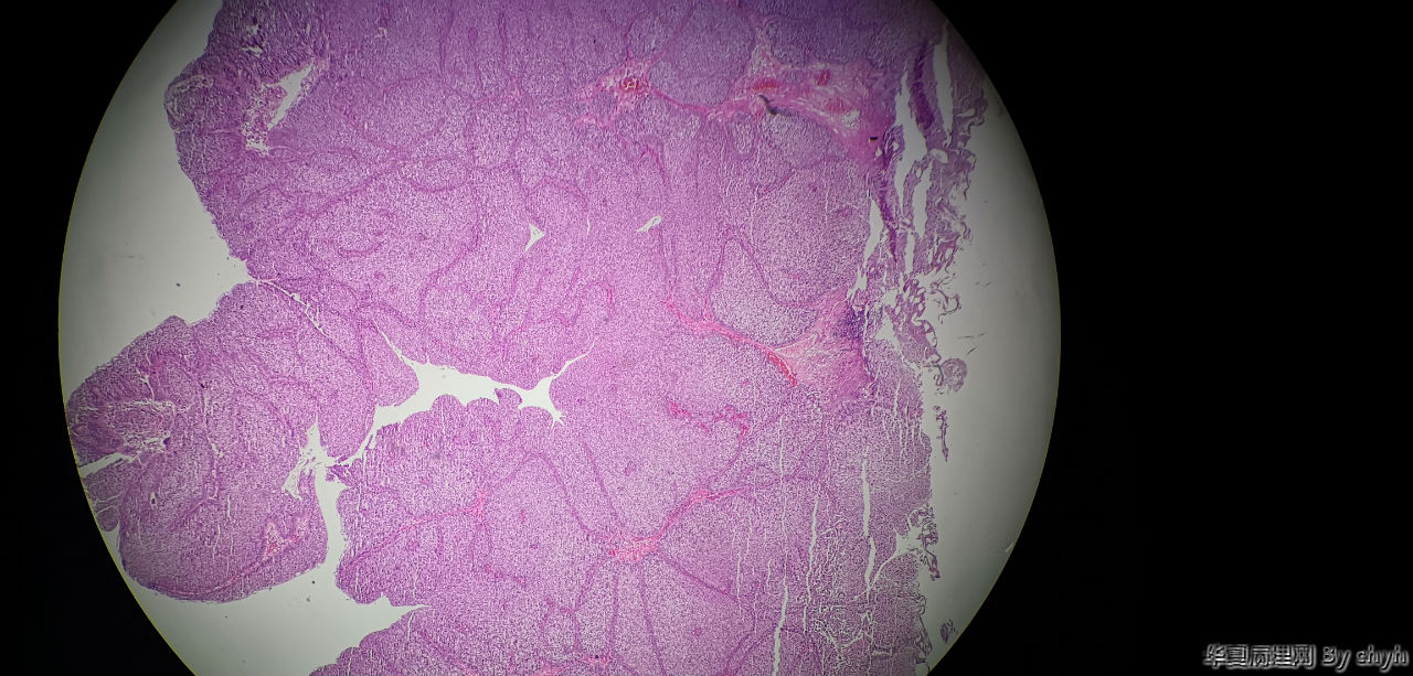 内镜下膀胱组织分类图像数据集