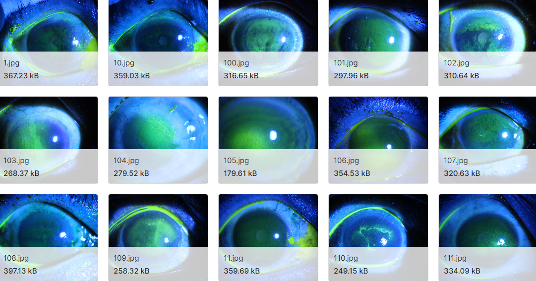 712例片状角膜溃疡的眼部染色图像数据集
