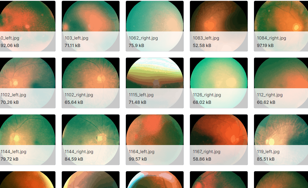 眼科疾病视网膜图像数据集