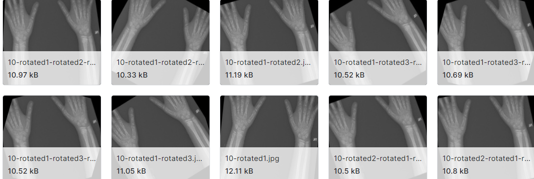 X射线描绘的几处关节骨折部位图片数据集
