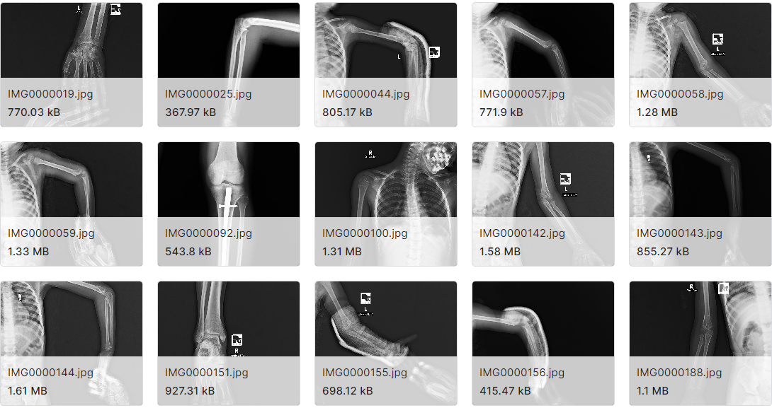 肌骨显像的分类、定位与分割图片数据集