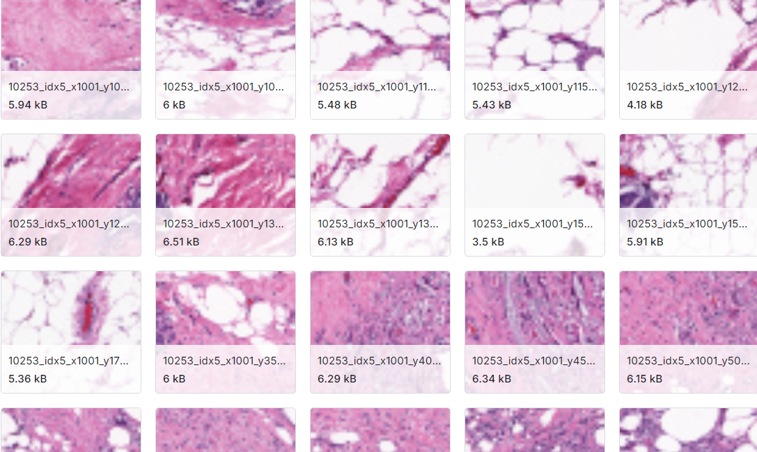 78，786个乳腺组织病理学模型图片数据集