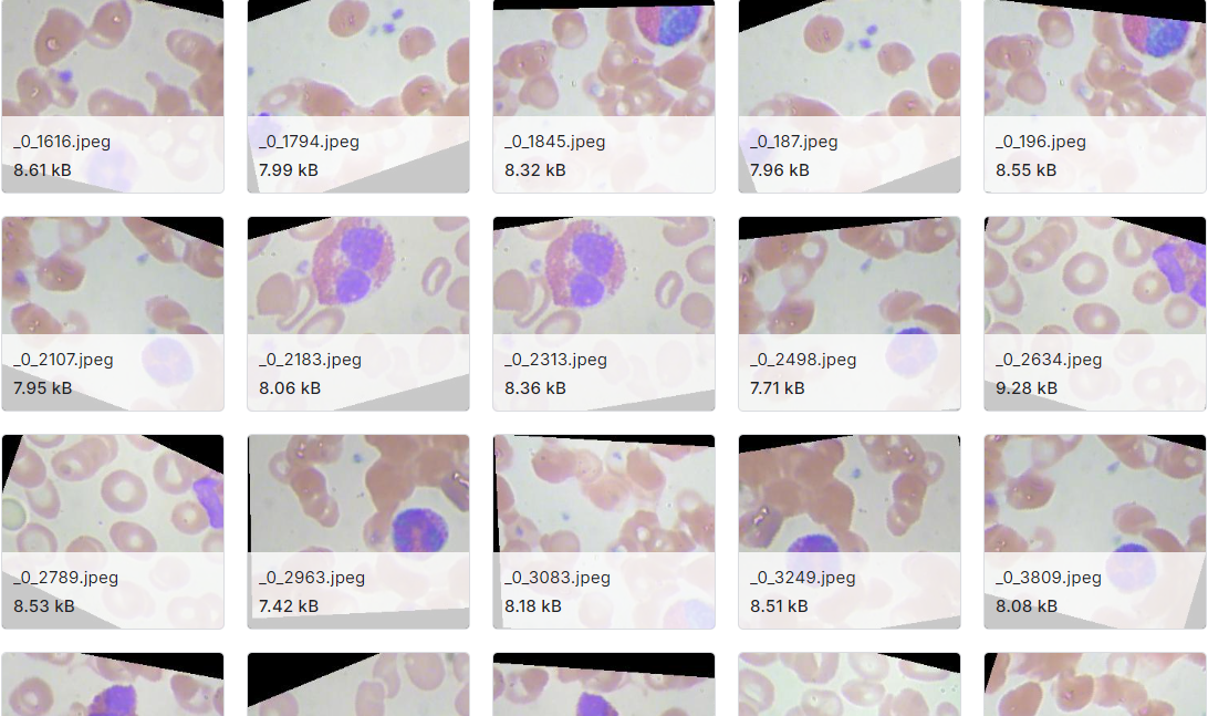 12500张图片四种不同类型的血细胞图片数据集