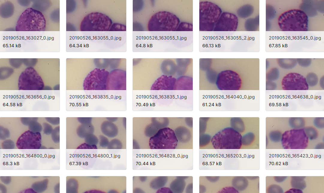 白细胞识别数据集