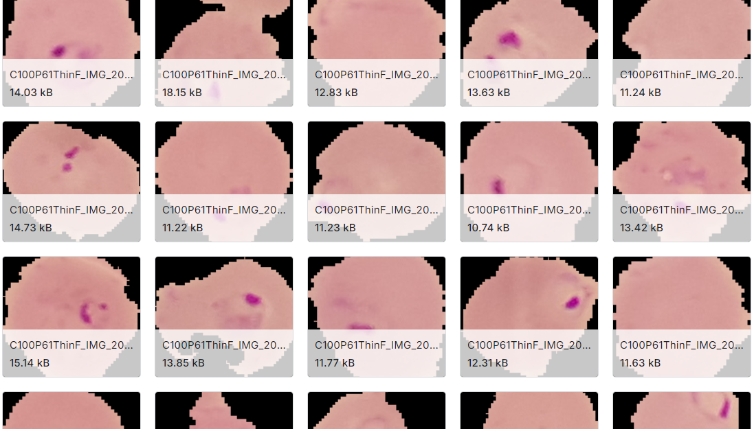 疟疾细胞图片数据集