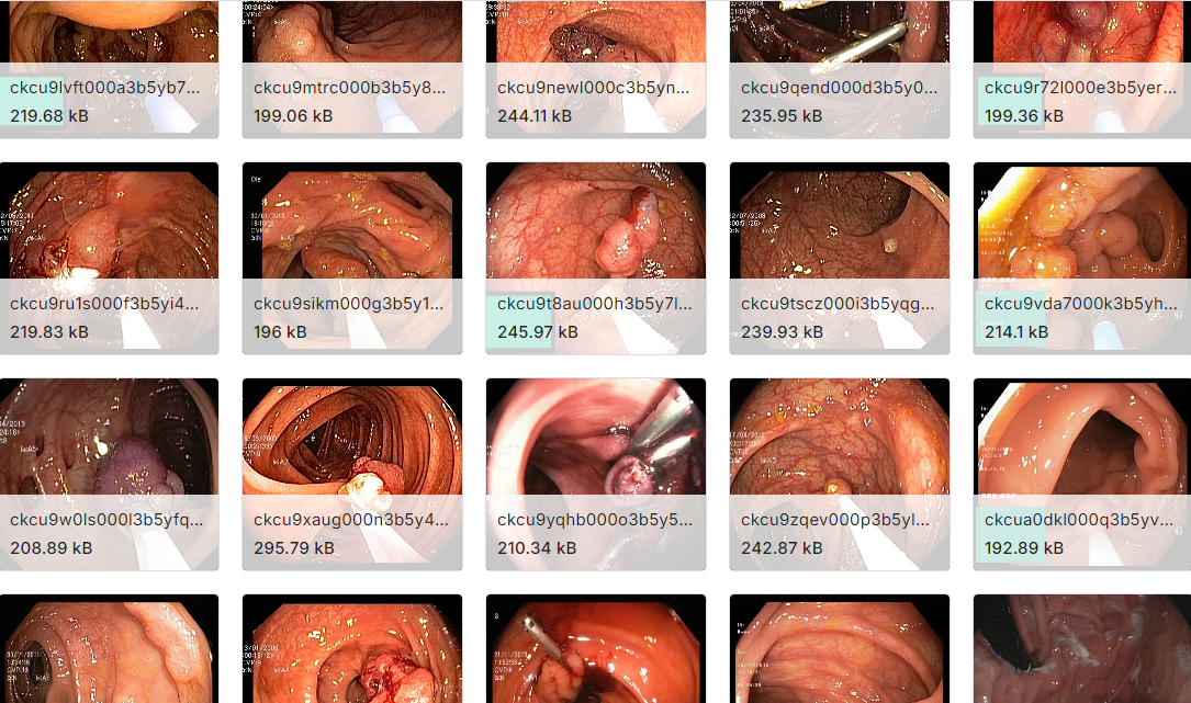 内窥镜仪器看到的图片数据集