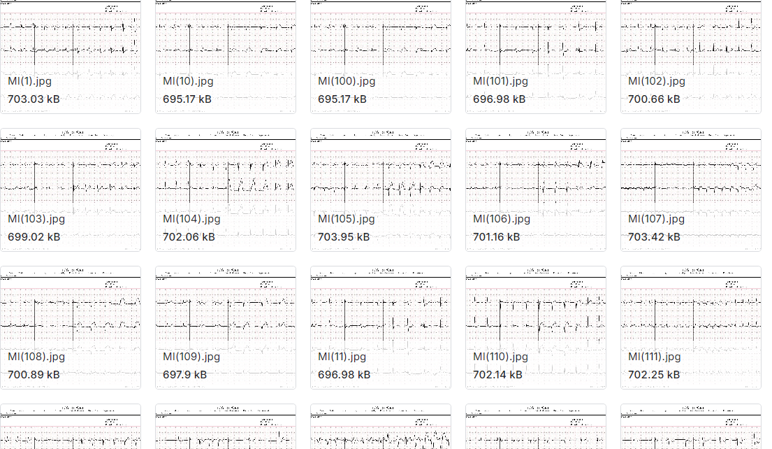 用于心血管研究和诊断的心电数据集