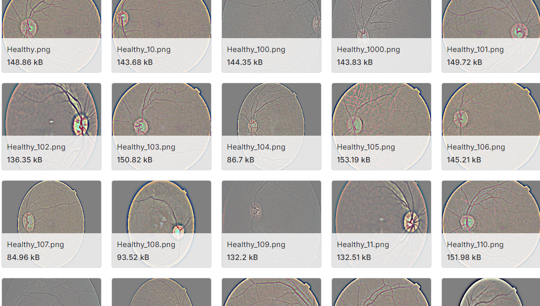糖尿病视网膜病变预处理数据集