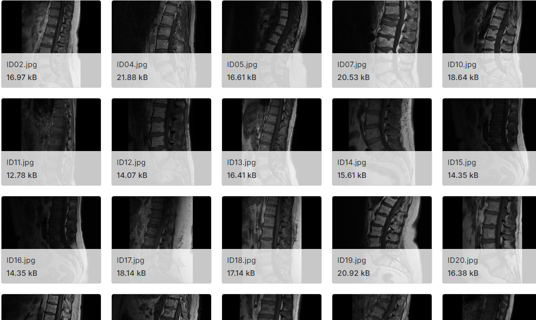 下腰椎的医学图像数据集