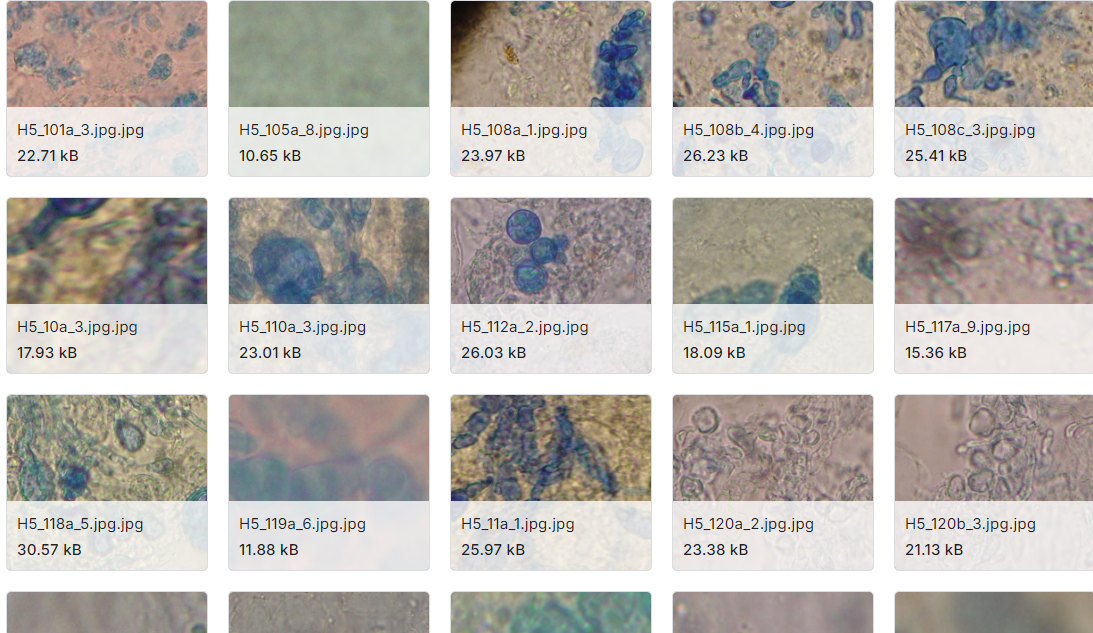 显微真菌图像-解真菌数据集