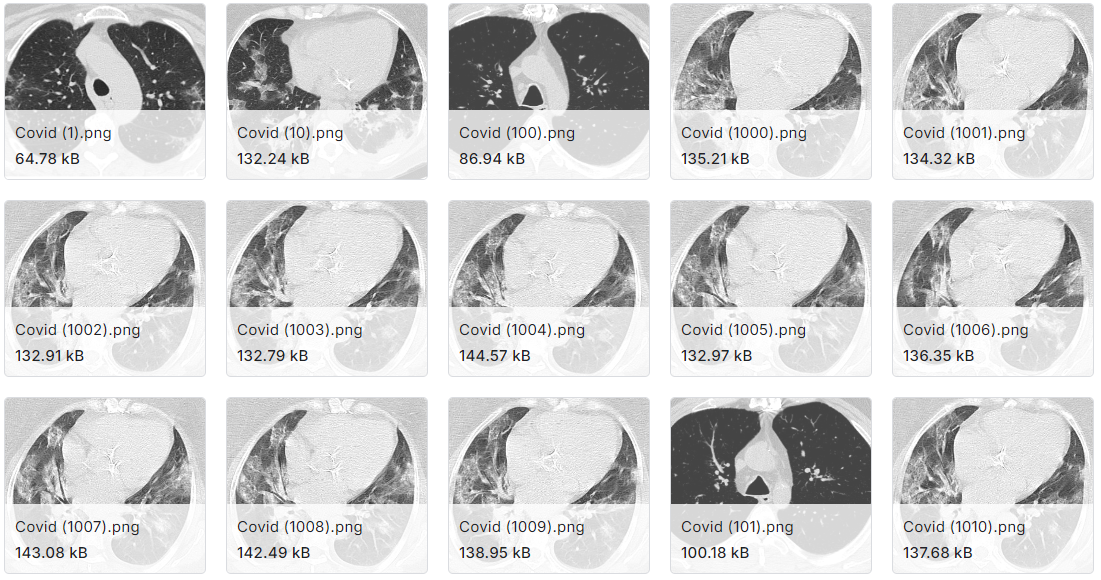 用于鉴定新型冠状病毒的大型CT扫描数据集