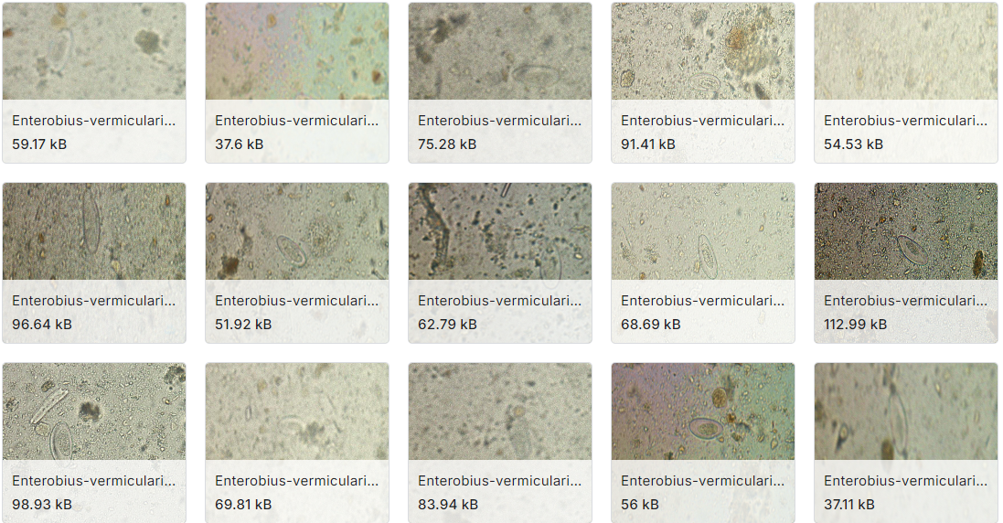 用于图像分析和检测任务的虫卵图像注释数据集