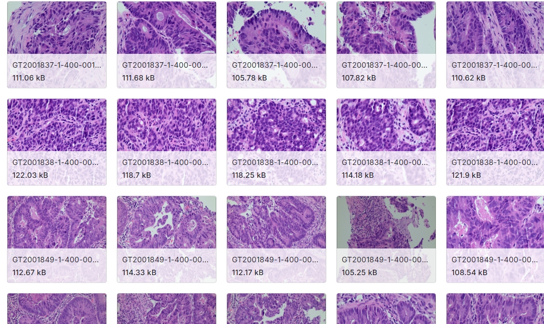 肠镜活检组织病理学血卟啉和伊红图像数据集