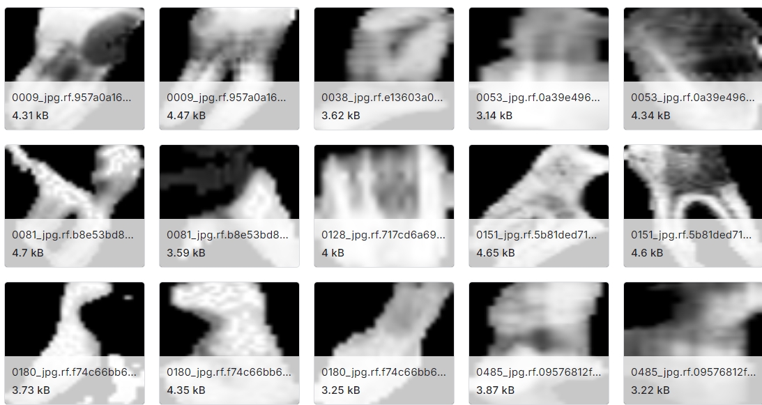 牙科放射学图像数据集