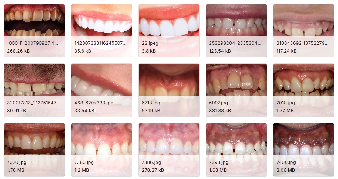 用标签工具标注的天然牙齿图像数据集