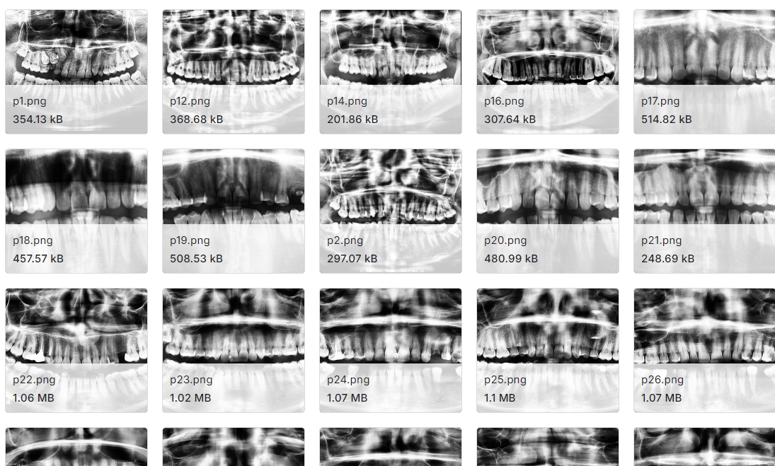 用于分析的牙科X射线图像数据集