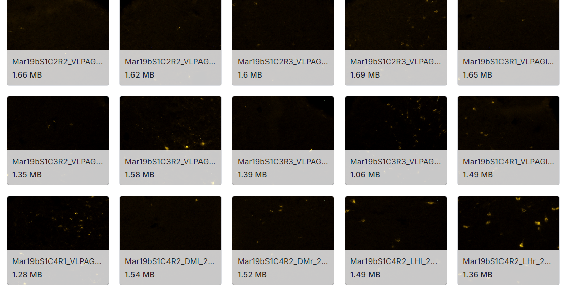 从荧光显微镜上获得283张小鼠脑片高分辨率图像数据集