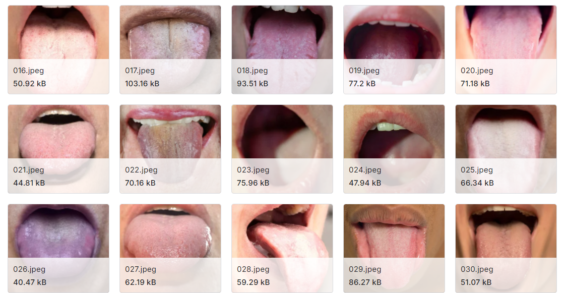 口腔癌图像数据集