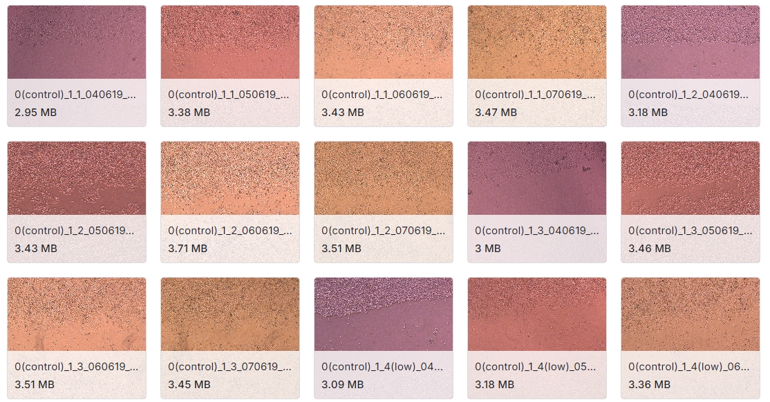 体外划痕试验获得的人类十二指肠腺癌HuTu 80细胞群图像数据集