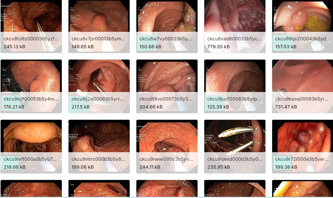 内窥镜所看到的图像数据集