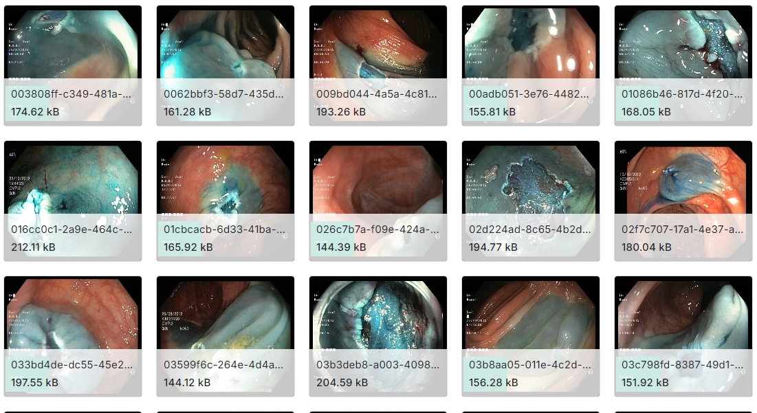 医学影像数据集