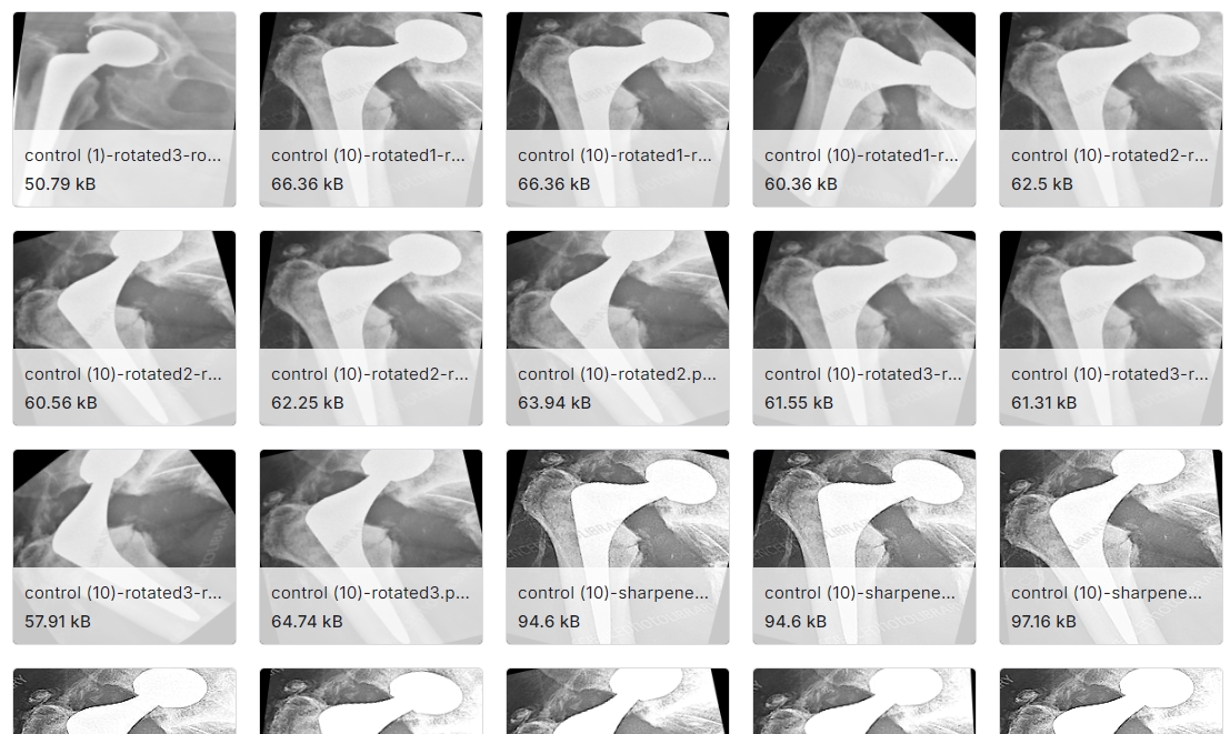从X光片中检测髋部植入物松动状况图像数据集