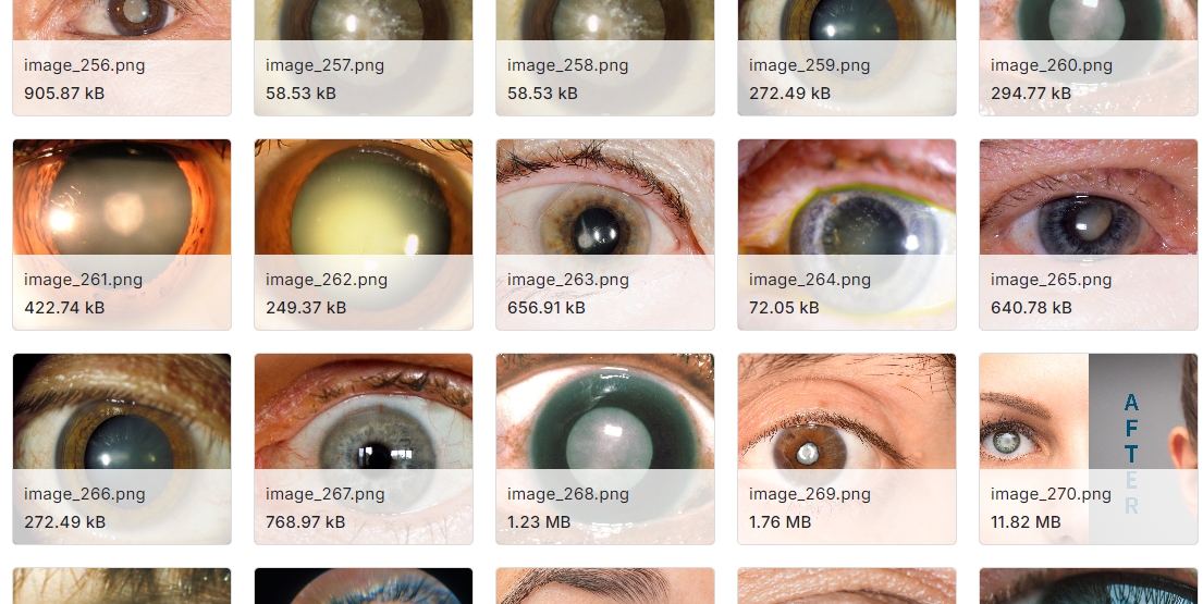 来自相机的青光眼图像数据集