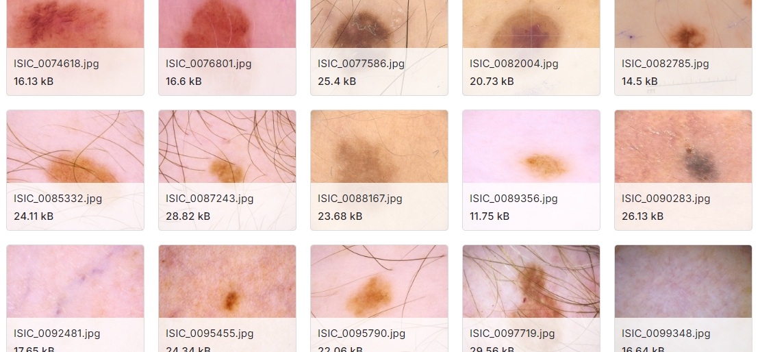 皮肤病变图像及其相应的元特征数据集